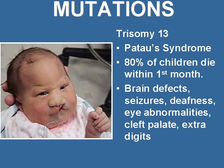 MUTATIONS Trisomy 13 • Patau’s Syndrome • 80% of children die within 1 st