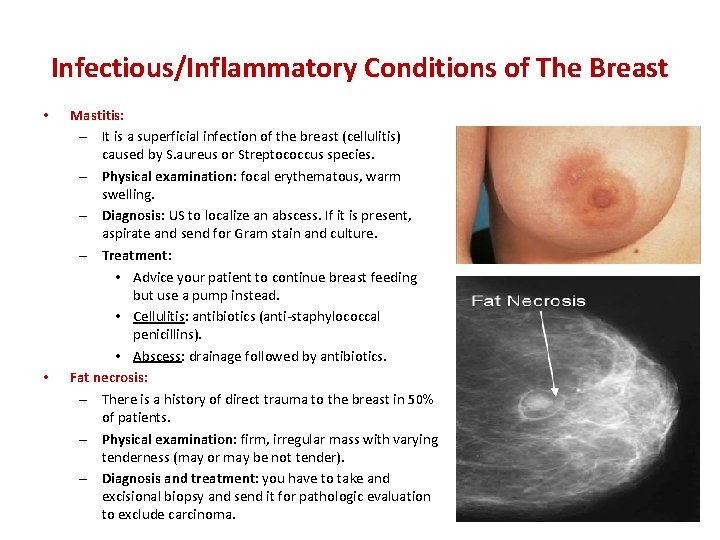 Infectious/Inflammatory Conditions of The Breast • • Mastitis: – It is a superficial infection