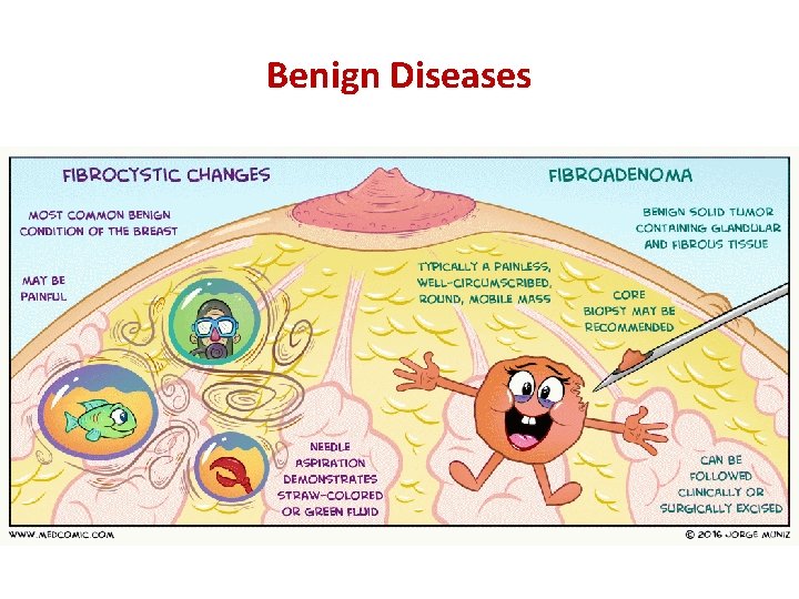Benign Diseases 