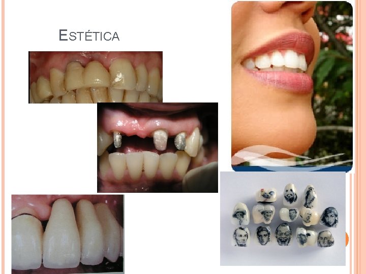 ESTÉTICA 