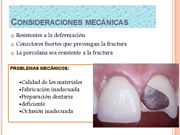CONSIDERACIONES MECÁNICAS Resistentes a la deformación Conectores fuertes que prevengan la fractura La porcelana
