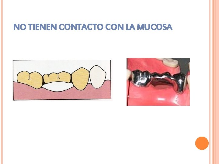 NO TIENEN CONTACTO CON LA MUCOSA 