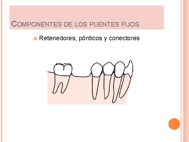 COMPONENTES DE LOS PUENTES FIJOS Retenedores, pónticos y conectores 