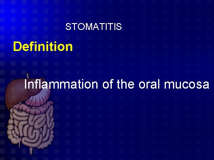 STOMATITIS Definition Inflammation of the oral mucosa 