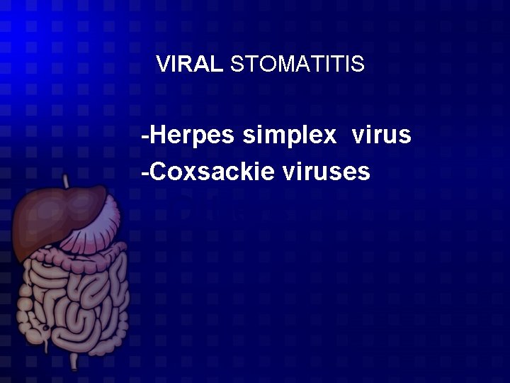 VIRAL STOMATITIS -Herpes simplex virus -Coxsackie viruses Others 