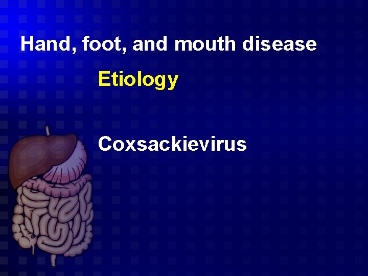 Hand, foot, and mouth disease Etiology Coxsackievirus 