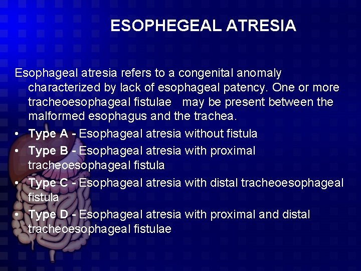 ESOPHEGEAL ATRESIA Esophageal atresia refers to a congenital anomaly characterized by lack of esophageal