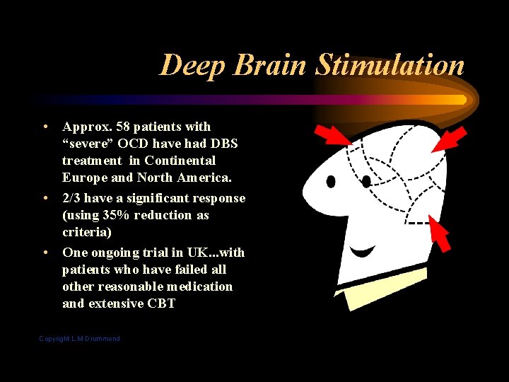 Deep Brain Stimulation • Approx. 58 patients with “severe” OCD have had DBS treatment