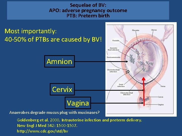 Sequelae of BV: APO: adverse pregnancy outcome PTB: Preterm birth Most importantly: 40 -50%