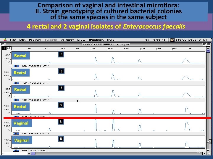 Comparison of vaginal and intestinal microflora: II. Strain genotyping of cultured bacterial colonies of