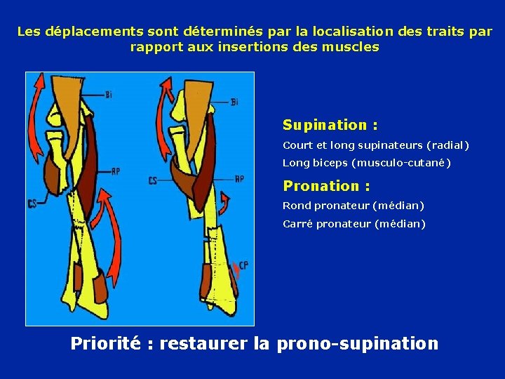 Les déplacements sont déterminés par la localisation des traits par rapport aux insertions des