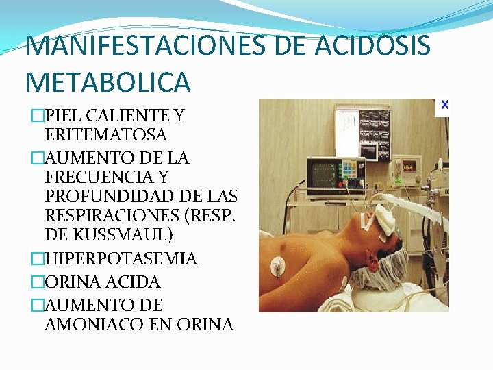 MANIFESTACIONES DE ACIDOSIS METABOLICA �PIEL CALIENTE Y ERITEMATOSA �AUMENTO DE LA FRECUENCIA Y PROFUNDIDAD