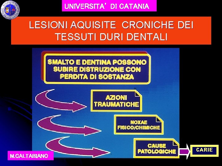 UNIVERSITA’ DI CATANIA LESIONI AQUISITE CRONICHE DEI TESSUTI DURI DENTALI M. CALTABIANO CARIE 