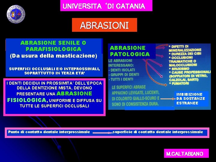 UNIVERSITA ‘DI CATANIA ABRASIONI ABRASIONE SENILE O PARAFISIOLOGICA (Da usura della masticazione) ABRASIONE PATOLOGICA