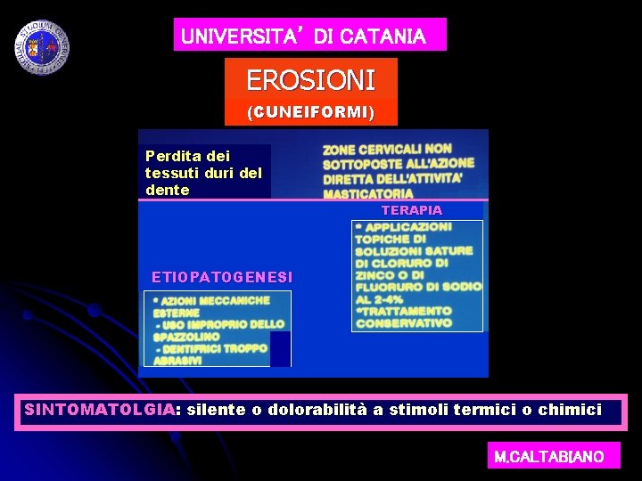 UNIVERSITA’ DI CATANIA EROSIONI (CUNEIFORMI) Perdita dei tessuti duri del dente TERAPIA ETIOPATOGENESI SINTOMATOLGIA: