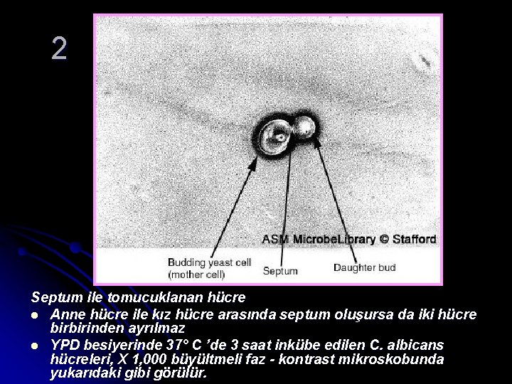 2 Septum ile tomucuklanan hücre l Anne hücre ile kız hücre arasında septum oluşursa