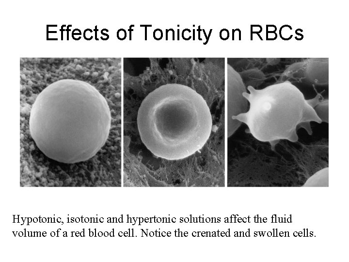 Effects of Tonicity on RBCs Hypotonic, isotonic and hypertonic solutions affect the fluid volume