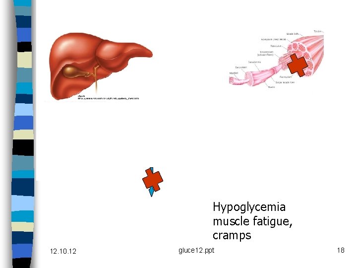 Hypoglycemia muscle fatigue, cramps 12. 10. 12 gluce 12. ppt 18 