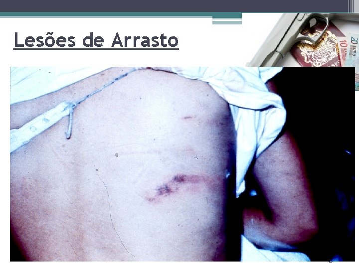 Lesões de Arrasto Page 8 