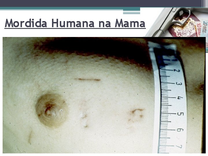 Mordida Humana na Mama Page 9 