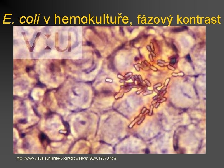 E. coli v hemokultuře, fázový kontrast http: //www. visualsunlimited. com/browse/vu 19873. html 