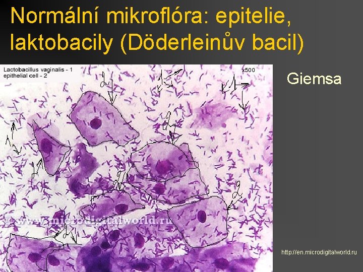 Normální mikroflóra: epitelie, laktobacily (Döderleinův bacil) Giemsa http: //en. microdigitalworld. ru 