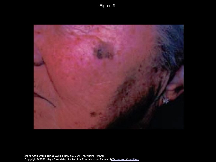 Figure 5 Mayo Clinic Proceedings 2006 81500 -507 DOI: (10. 4065/81. 4. 500) Copyright
