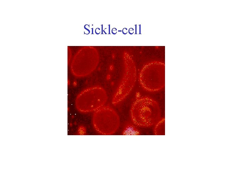 Sickle-cell 