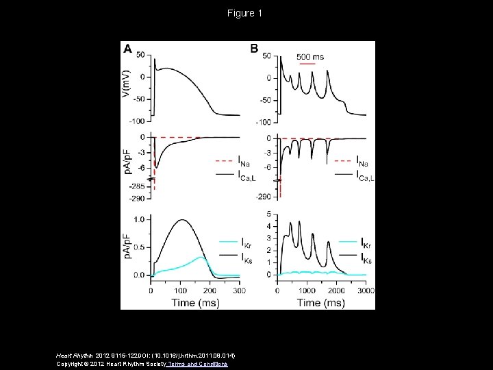 Figure 1 Heart Rhythm 2012 9115 -122 DOI: (10. 1016/j. hrthm. 2011. 08. 014)