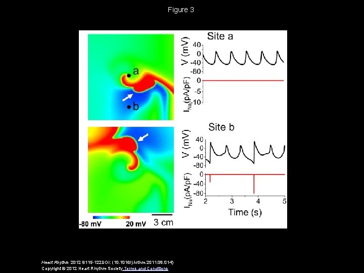 Figure 3 Heart Rhythm 2012 9115 -122 DOI: (10. 1016/j. hrthm. 2011. 08. 014)