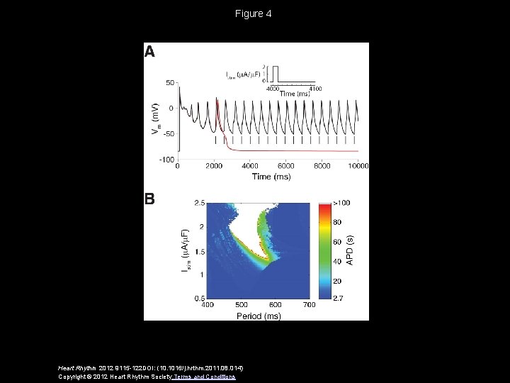 Figure 4 Heart Rhythm 2012 9115 -122 DOI: (10. 1016/j. hrthm. 2011. 08. 014)