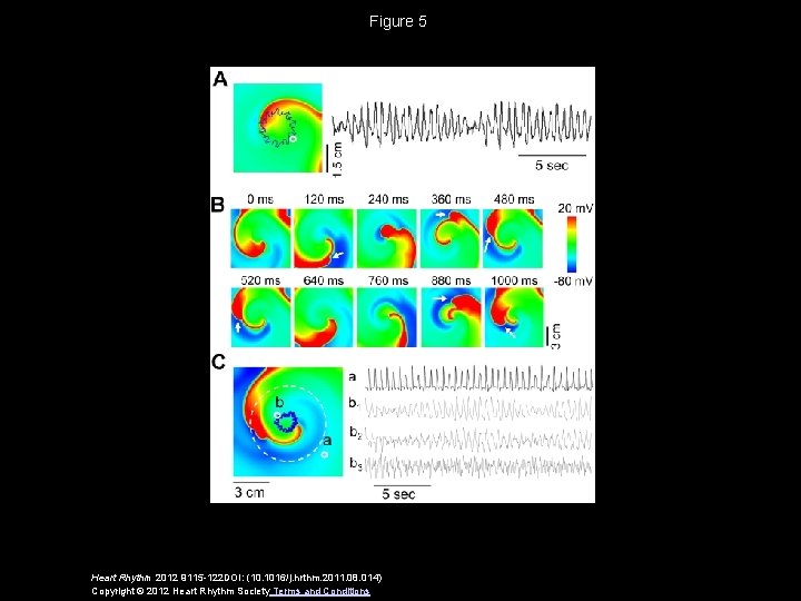 Figure 5 Heart Rhythm 2012 9115 -122 DOI: (10. 1016/j. hrthm. 2011. 08. 014)