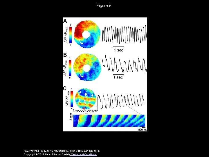 Figure 6 Heart Rhythm 2012 9115 -122 DOI: (10. 1016/j. hrthm. 2011. 08. 014)