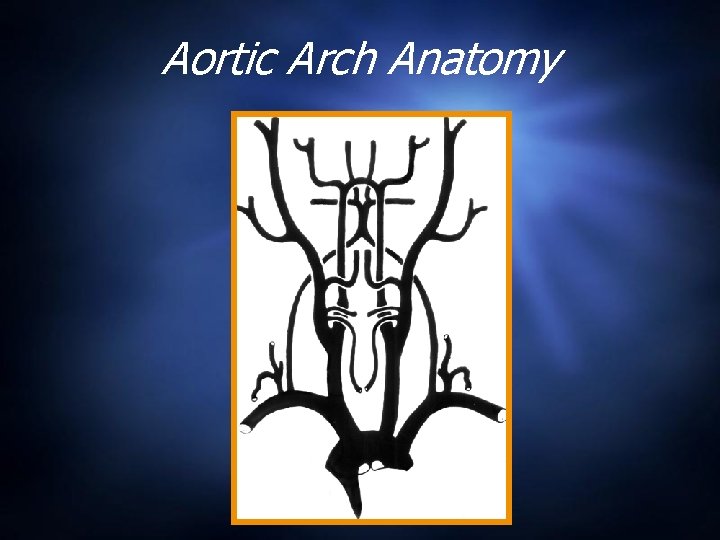 Aortic Arch Anatomy 