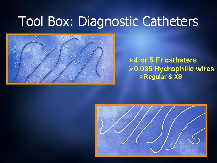 Tool Box: Diagnostic Catheters Ø 4 or 5 Fr catheters Ø 0. 035 Hydrophilic