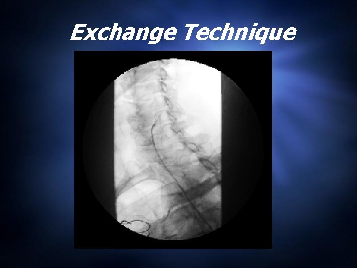 Exchange Technique 