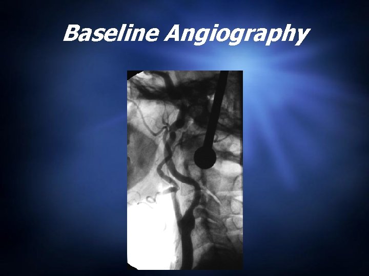 Baseline Angiography 