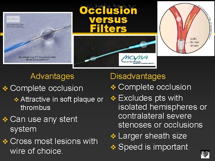 Occlusion versus Filters Disadvantages v Complete occlusion v Attractive in soft plaque or v