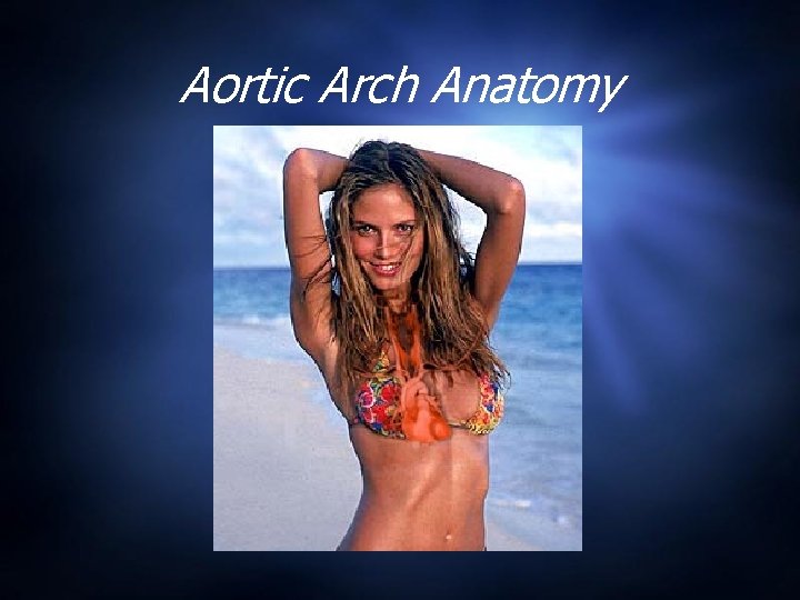 Aortic Arch Anatomy 