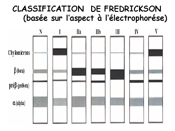 CLASSIFICATION DE FREDRICKSON (basée sur l’aspect à l’électrophorése) 