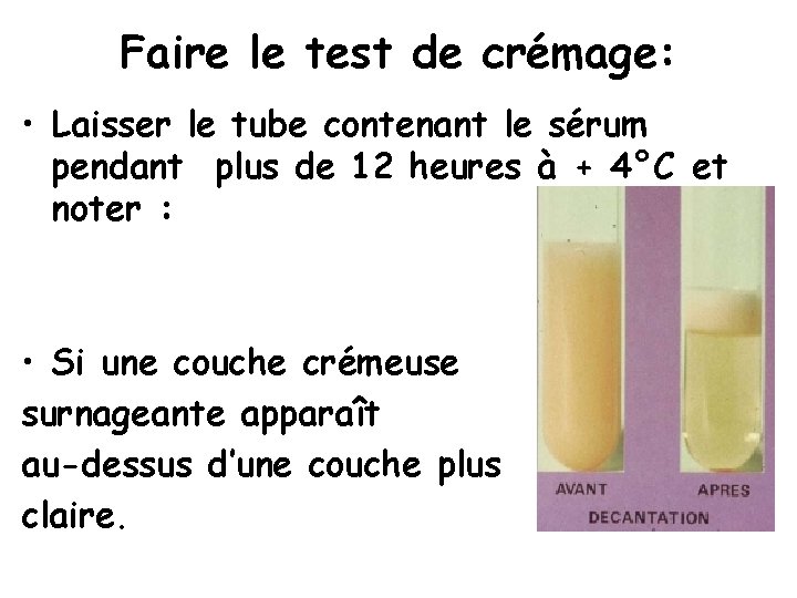 Faire le test de crémage: • Laisser le tube contenant le sérum pendant plus