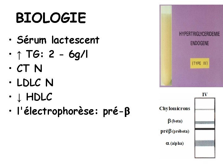 BIOLOGIE • • • Sérum lactescent ↑ TG: 2 - 6 g/l CT N