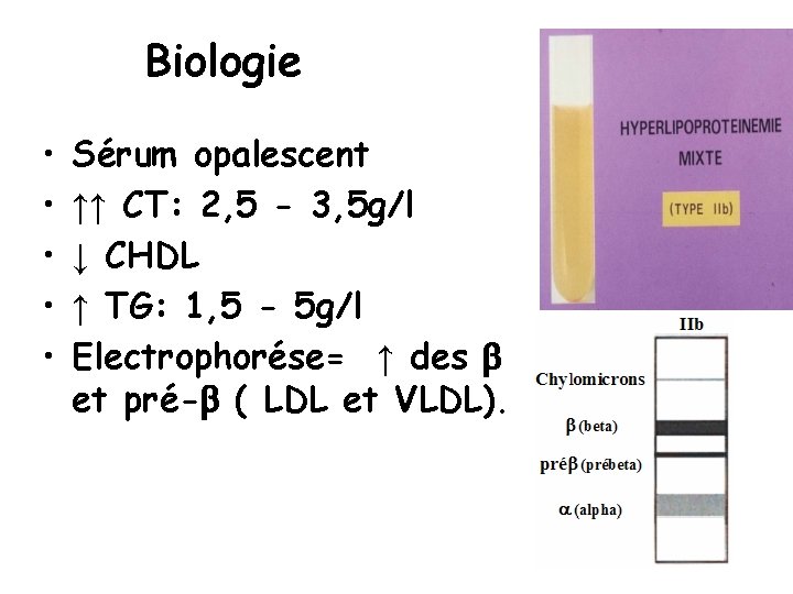 Biologie • • • Sérum opalescent ↑↑ CT: 2, 5 - 3, 5 g/l
