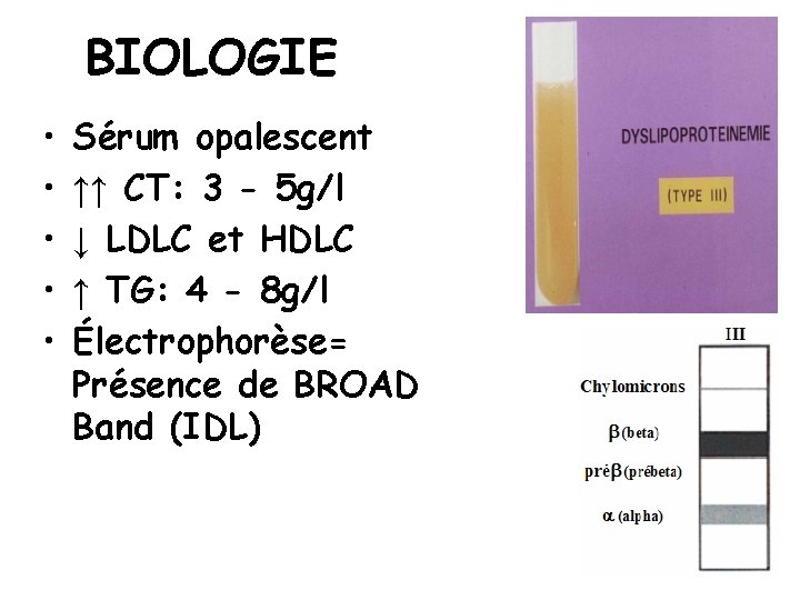 BIOLOGIE • • • Sérum opalescent ↑↑ CT: 3 - 5 g/l ↓ LDLC