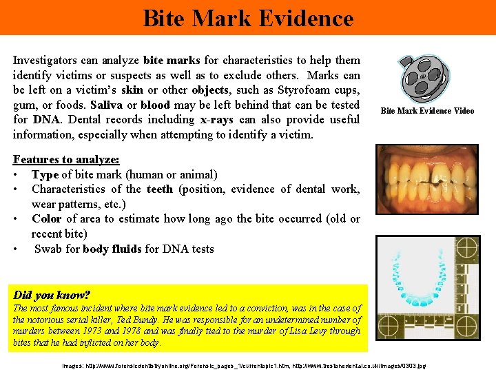 Bite Mark Evidence Investigators can analyze bite marks for characteristics to help them identify Bite Mark Evidence Investigators can analyze bite marks for characteristics to help them identify