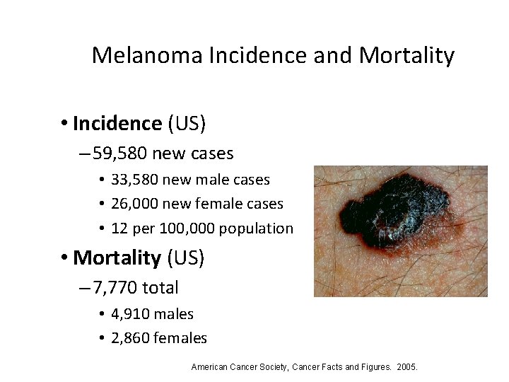 Melanoma Incidence and Mortality • Incidence (US) – 59, 580 new cases • 33,