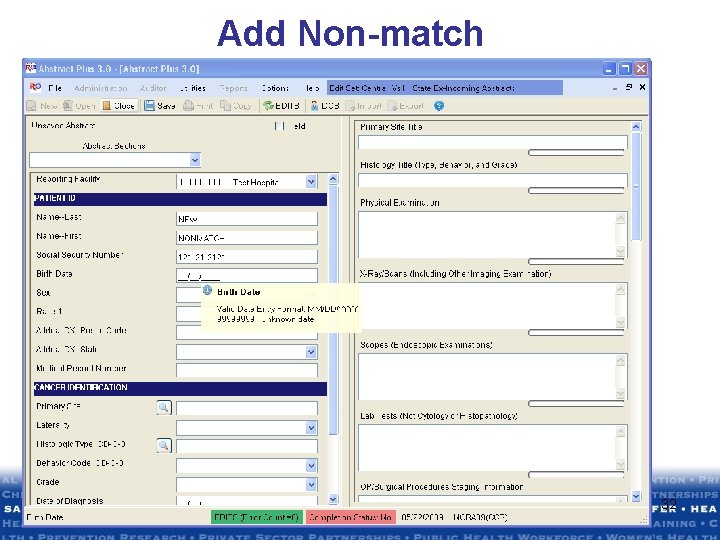 Add Non-match 32 Add Non-match 32