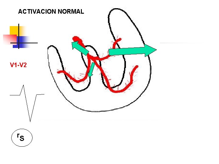 ACTIVACION NORMAL V 1 -V 2 r. S 