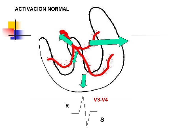 ACTIVACION NORMAL V 3 -V 4 R S 