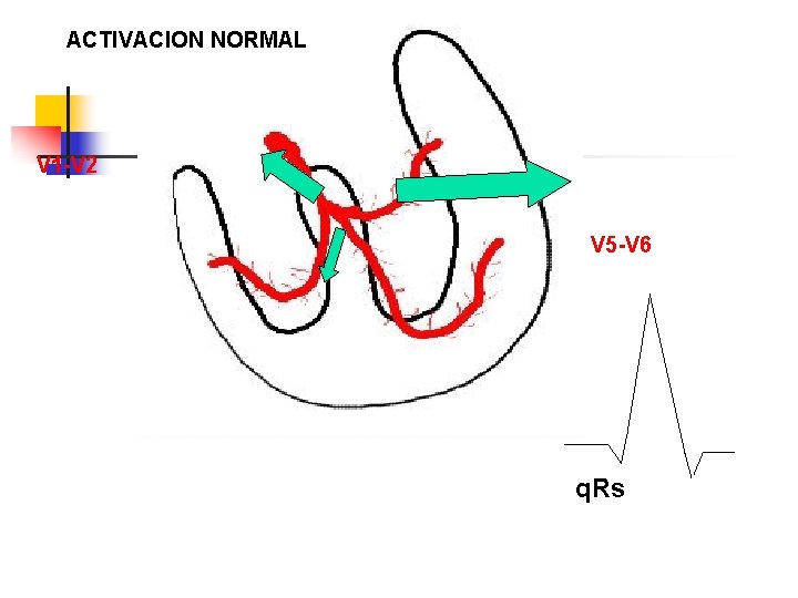 ACTIVACION NORMAL V 1 -V 2 V 5 -V 6 q. Rs 